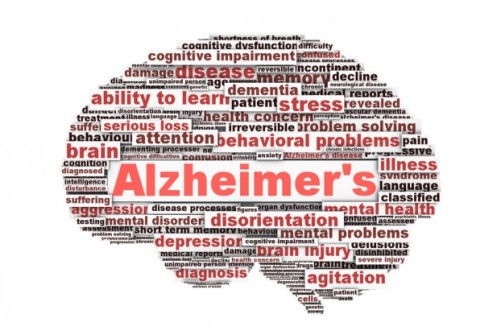alzheimers-disease1